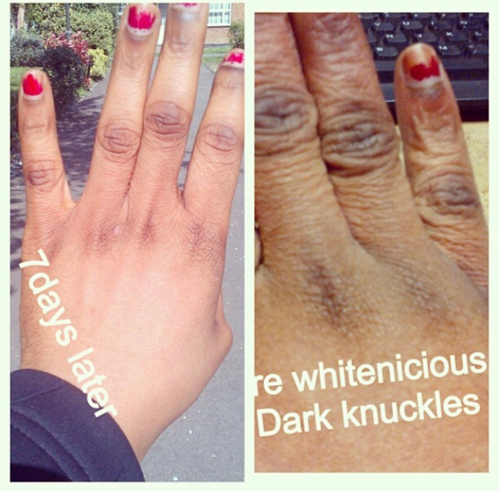 Inner Thigh lightening Cream – Whitenicious By Dencia