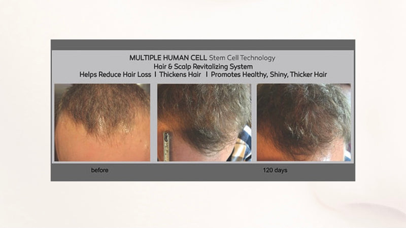 Hair Re-growth & Strengthening Spray with MHCsc™ Technology
